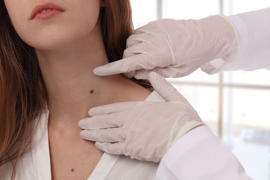 Lipoma: Causes, Symptoms, Treatment, and Prevention