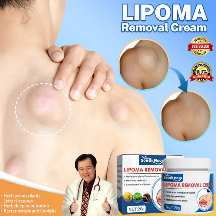 Lipoma Removal Cream